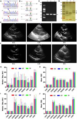 Mutant Single Nucleotide Polymorphism rs189037 in Ataxia-Telangiectasia Mutated Gene Is Significantly Associated With Ventricular Wall Thickness and Human Lifespan